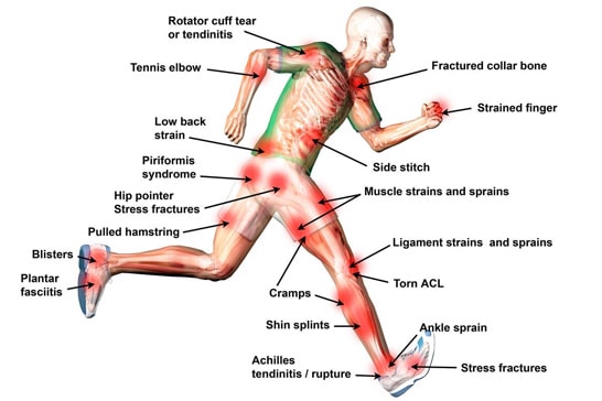 Sports Injury