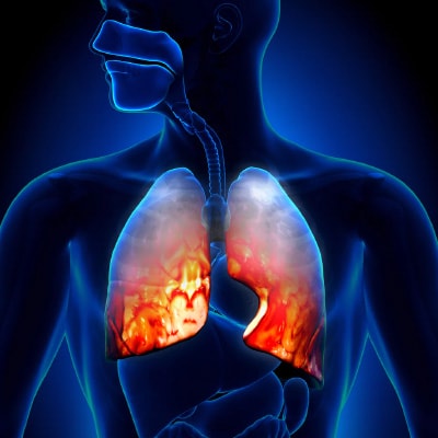 Cancer-Pain-Treatments