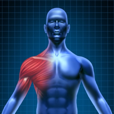 Muscle-Pain-Treatments